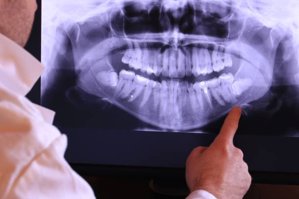 Best Emergency Treatment for Jaw Pain or Injury in Panama City, FL